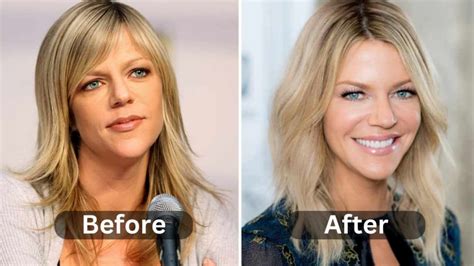 Kaitlin Olson’s Plastic Surgery Rumors: What Has the。